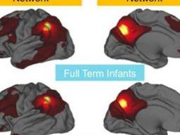 Frühgeburt kann die Gehirnverbindungen von Babys schwächen