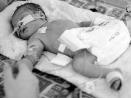 Frühgeborene Kinder mit hohem Risiko von grippebedingten Komplikationen, Studien findet
