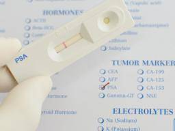 Rakovina prostaty: mel by být screening PSA rutinní?