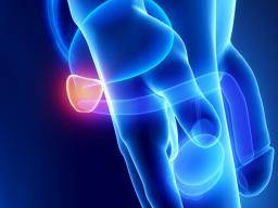Rakovina prostaty zamerená na ultrazvuk "by mohla premenit lécbu"