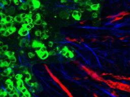 Protein hilft Krebszellen Wege für die Migration zu ebnen