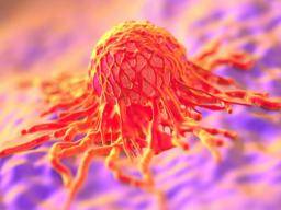 Protein identifikuje agresivní rakovinové bunky, pripravené k sírení