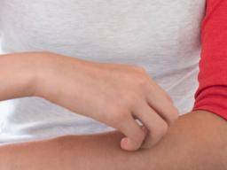Psoriasis en niños: síntomas, tratamientos y causas