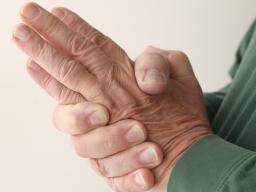 Rezidivierend-remittierende multiple Sklerose: Symptome, Behandlung und Ausblick