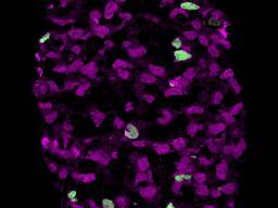 Les chercheurs créent des précurseurs d'oeufs et de spermatozoïdes à l'aide de cellules souches embryonnaires humaines