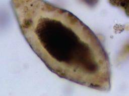 Forscher entdecken 6.200 Jahre altes Schistosomiasis-Parasitenei