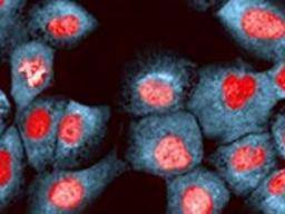 Le remodelage des cellules tumorales pourrait être une nouvelle façon de traiter le cancer du sein