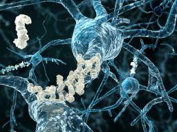 El estudio del resveratrol ofrece una nueva visión del Alzheimer