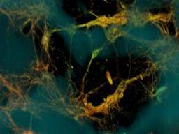 Los científicos construyen el primer modelo funcional de tejido cerebral 3D