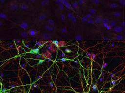 Wissenschaftler wandeln menschliche Hautzellen direkt in Gehirnzellen um