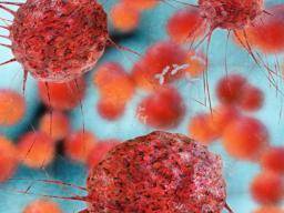 Wissenschaftler identifizieren neues Gen, das triple-negativen Brustkrebs treibt