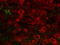 Des scientifiques arrêtent et inversent les lésions cérébrales liées à la maladie d'Alzheimer chez la souris