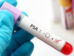 Sept causes d'un taux élevé de PSA qui ne sont pas un cancer