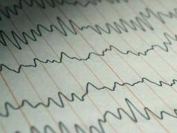 Epilepsia severa y proteína del ritmo circadiano vinculada