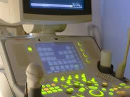 Spezial-Ultraschall erkennt Herzprobleme bei Patienten mit rheumatoider Arthritis