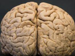 Specifická technika výcviku mozku ukázala, ze snizuje riziko demencí