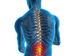 Rückenmarkstimulationseffizienz mit implantiertem Gerät mit drei Elektrodenspalten verstärkt