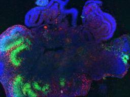 Stammzelle "Mini-Gehirn" sehr ähnlich zu echtem Gehirn, Studie findet