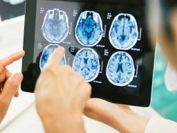 Studie zeigt neurologische Mechanismen in Gehirnerschütterungen