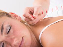 Studie ukazuje, proc by akupunktura mohla fungovat