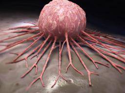 «Super suppresseur de tumeur» trouvé pour prévenir le cancer du pancréas