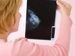 Synchrone Radiochemotherapie senkt das Risiko, dass Brustkrebs zurückkommt
