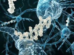 Cílení proteinu spánku-bdení muze zabránit Alzheimerove chorobe