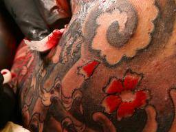 Tattoos können Jahre der Infektion, Juckreiz und Schwellungen verursachen