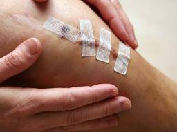 Dix blessures communes au genou et traitement