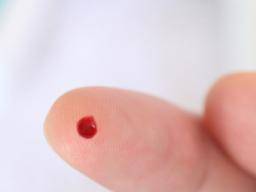 Výsledky testu krve v ocích prstu se lisí od poklesu k poklesu