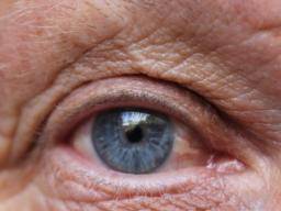Eine Behandlung, die den AMD-Sehverlust mit einer Stammzelleninjektion verlangsamt, ist vielversprechend