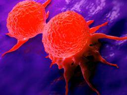Triple-negativní karcinom prsu: Studie prolaktinu mohou vést k nové lécbe
