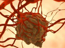 Gen pro supresor nádoru podporuje nekteré rakoviny kolorekta