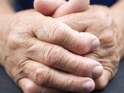 Doce signos tempranos de artritis reumatoide