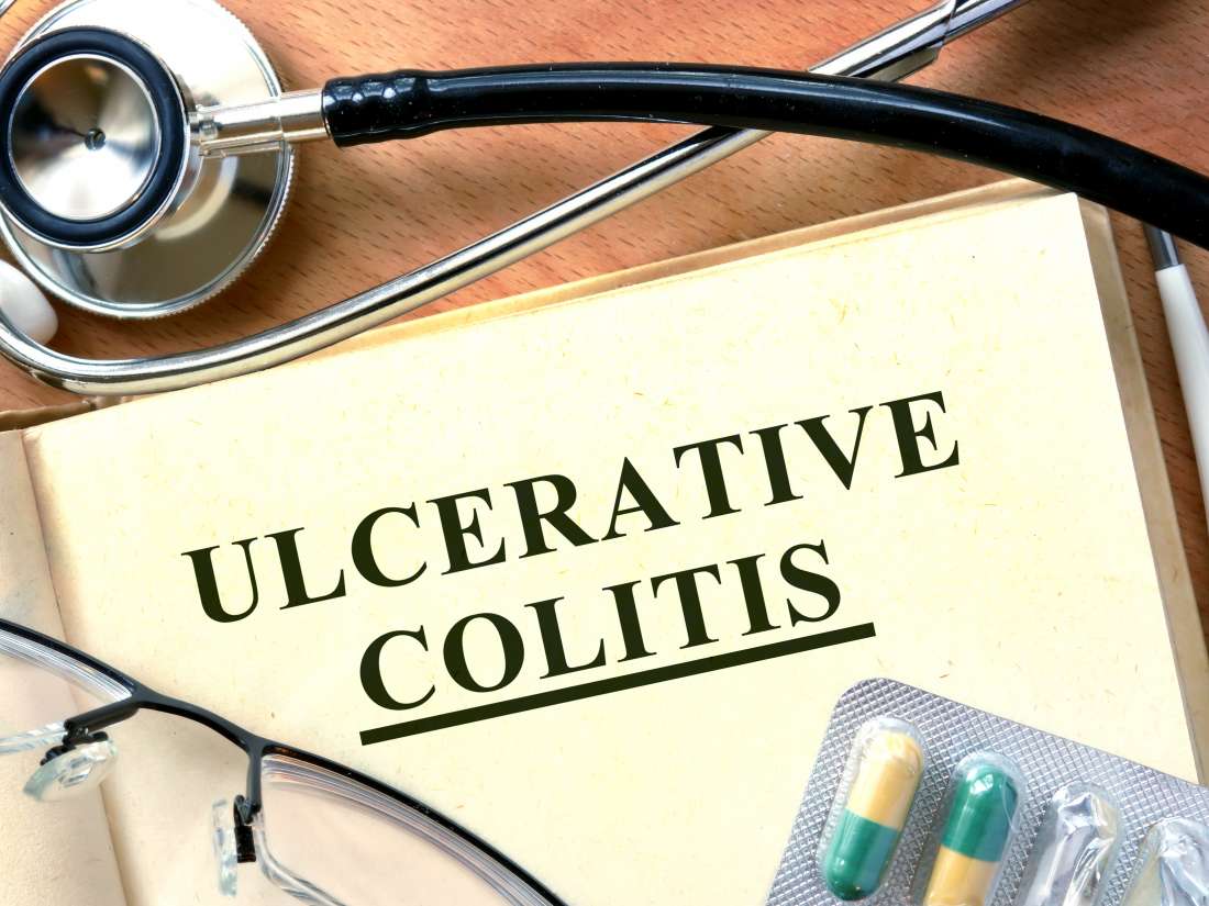 Colitis ulcerosa: Was Sie wissen müssen