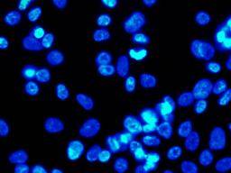 Que sont les cellules souches et pourquoi sont-elles importantes?