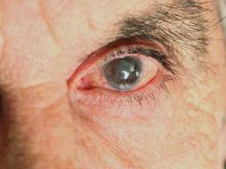 Was sind die häufigsten Ursachen für Augenschmerzen?