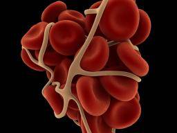 Jaké jsou príznaky krevní srazeniny?