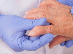 Was sind die Symptome der Psoriasis-Arthritis?
