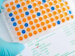 Jaké jsou testy Western blot a ELISA pro HIV?