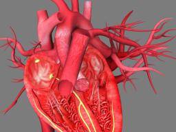 Co je to hypertrofická kardiomyopatie?