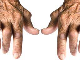 Was ist seronegative rheumatoide Arthritis?
