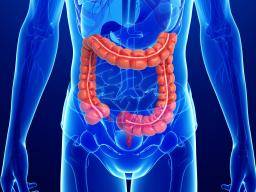Was ist der Unterschied zwischen Morbus Crohn und Colitis ulcerosa?