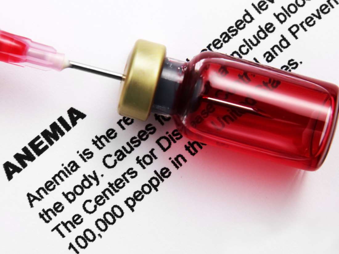 Qué saber sobre la anemia por deficiencia de hierro