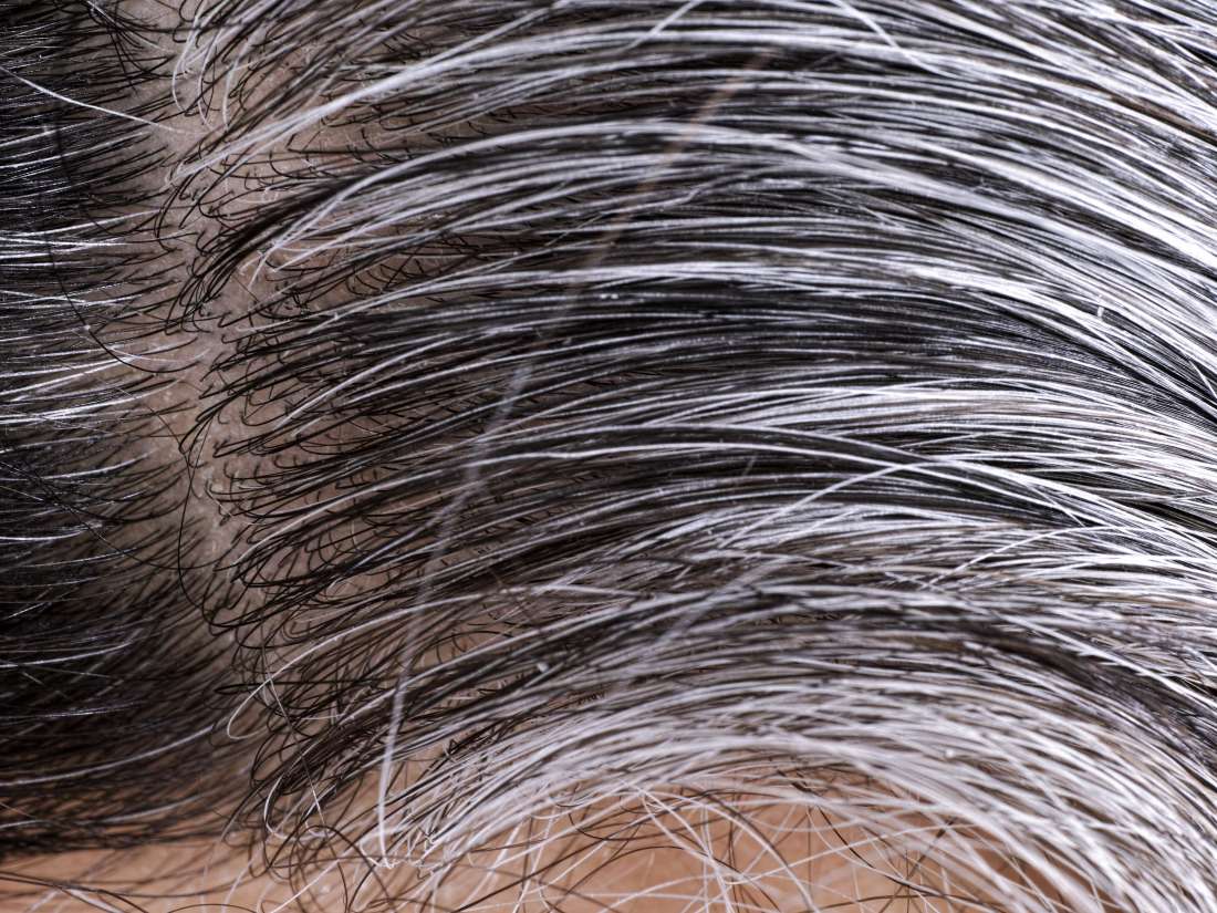 Ce que vous devez savoir sur les cheveux blancs