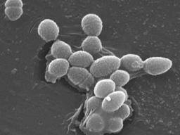 Was ist über Enterococcus faecalis zu wissen?