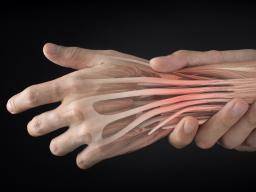 Ka reikia zinoti apie Extensor tendonitas?