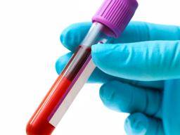 Que faut-il savoir sur la faible CCMH dans les tests sanguins?