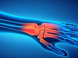 Schmerzen am Handgelenk: Ursachen, Symptome und Behandlung